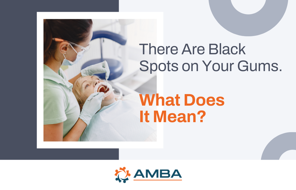 There Are Black Spots on Your Gums. What Does It Mean?